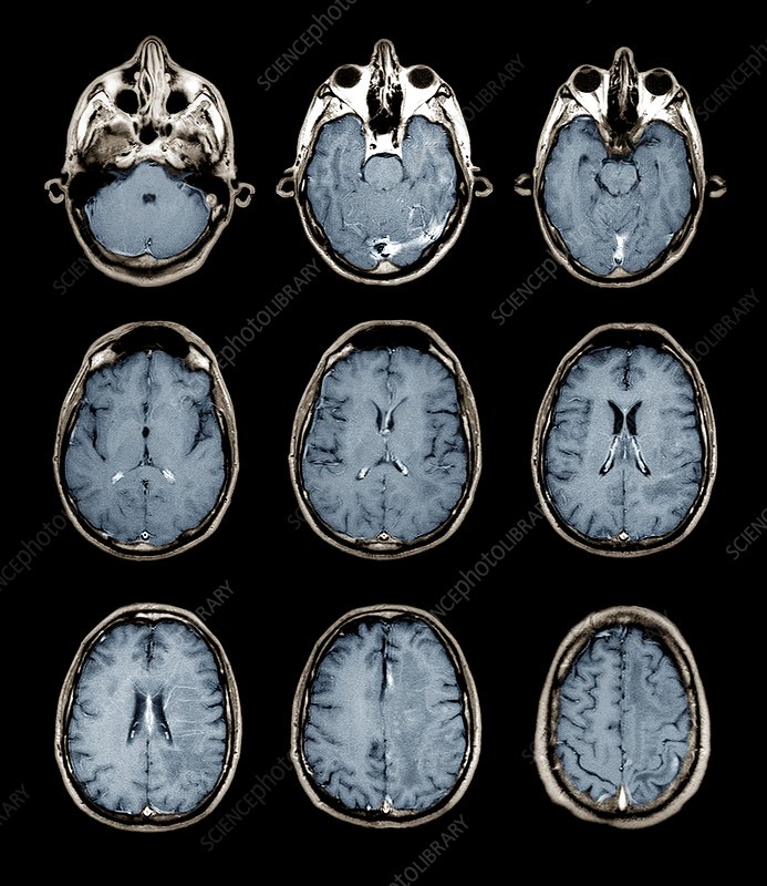 AlzAI Image 1