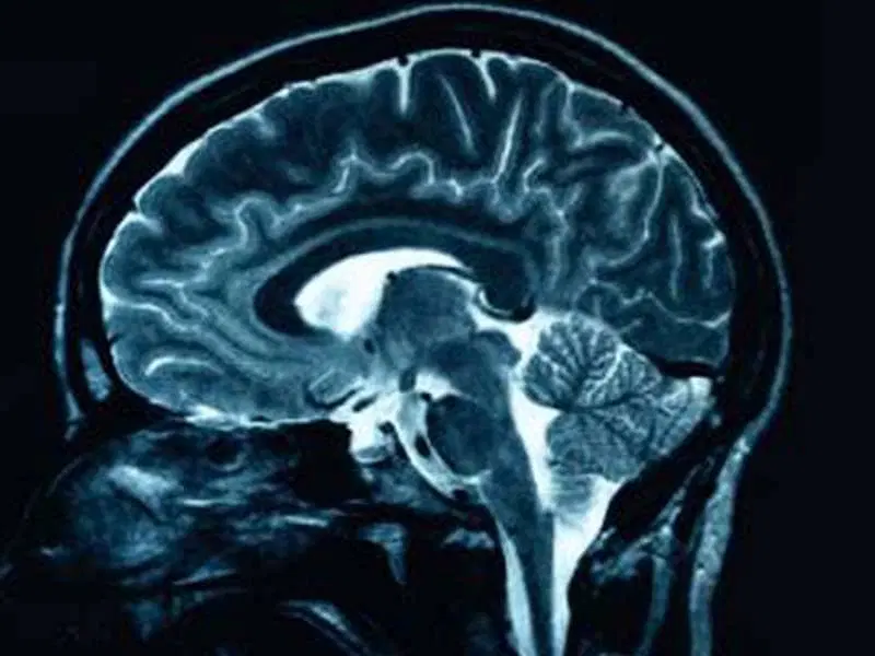 AlzAI Image 2